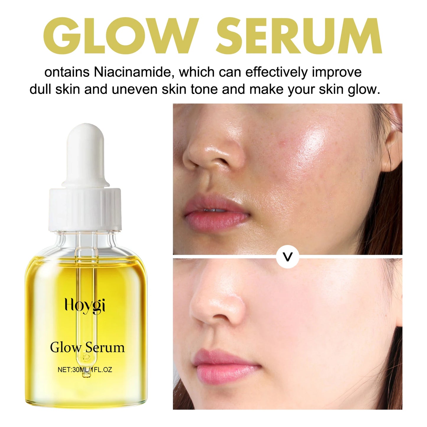 Propolis & Niacinamide Brightening Serum (30ml) – Dark Spot & Wrinkle Repair Essence