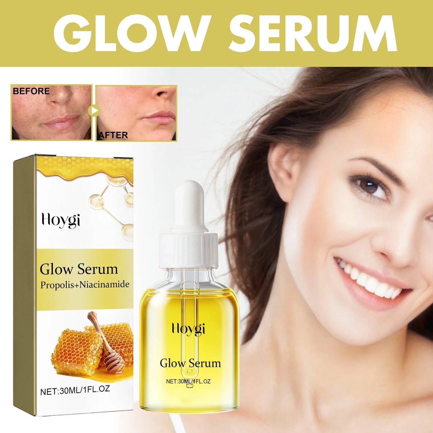 Propolis & Niacinamide Brightening Serum (30ml) – Dark Spot & Wrinkle Repair Essence