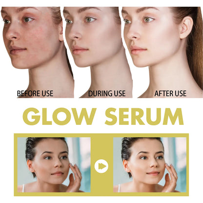 Propolis & Niacinamide Brightening Serum (30ml) – Dark Spot & Wrinkle Repair Essence
